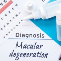 Macular Degeneration – Causes, Symptoms, and More